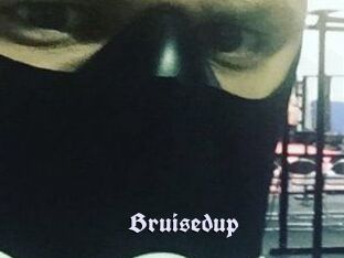 Bruisedup